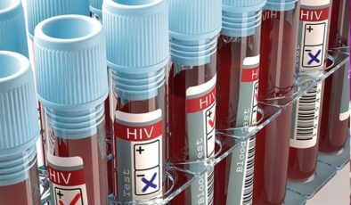 HIV virüsü nedir, belirtileri nelerdir? HIV Enfeksiyonu (AIDS) nasıl bulaşır?